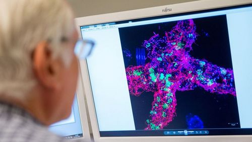 Meinhard Simon und seine Forschungsobjekte: Um Meeresmikroben sichtbar zu machen, werden die winzigen Organismen mit Fluoreszenzfarbstoffen angefärbt. Universität Oldenburg / Daniel Schmidt
