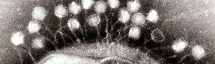 Transmission electron micrograph of multiple bacteriophages attached to a bacterial cell wall