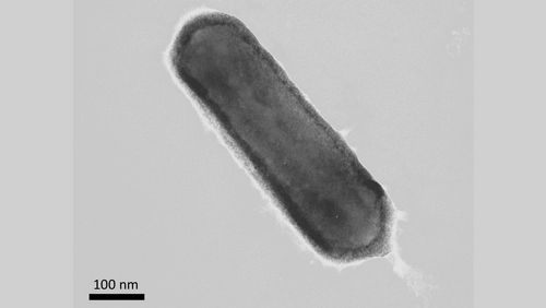 Der Einzeller Nitrosopumilus maritimus kann Sauerstoff produzieren. Das haben Forschende der Universität Oldenburg und der Syddansk Universiteit nachgewiesen – erstmals bei einem Organismus aus der Domäne der Archaeen. Foto: Uni Oldenburg