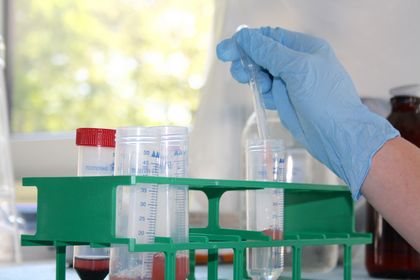 Forschung Abteilung für experimentelle Allergologie und Immundermatologie