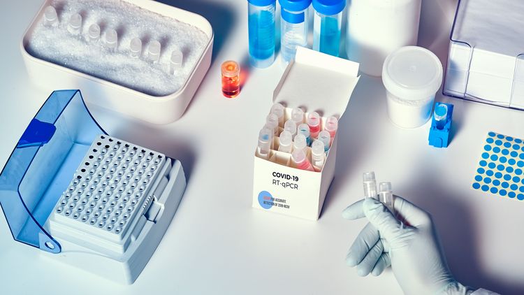 Auf dem Bild ist ein Testkit zu sehen, bestehend aus einigen Proben, einem speziellen Behälter, um die Virus-RNA zu vervielfältigen und weiteres Labormaterial.
