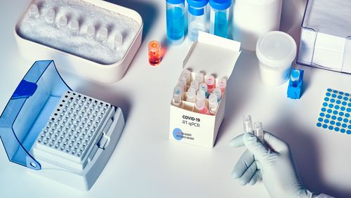 Auf dem Bild ist ein Testkit zu sehen, bestehend aus einigen Proben, einem speziellen Behälter, um die Virus-RNA zu vervielfältigen und weiteres Labormaterial.