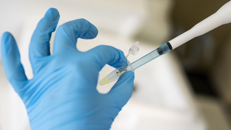 Großaufnahme von Hand und Kunststoffröhrchen plus Pipette.