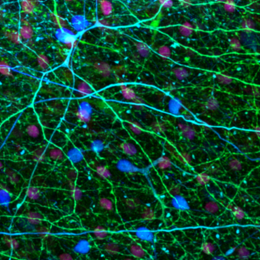 Calbindin immunoreactivity in the pigeon retina Karen Dedek