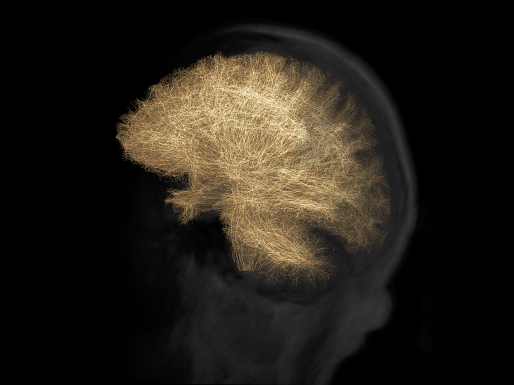 Structural Connectivity in the Human Brain —  Ole Hausendorf — Das Bild zeigt die strukturelle Konnektivität von zwanzigtausend neuronalen Verbindungen im menschlichen Gehirn, dargestellt durch die Diffusion-Tensor-Imaging-Technik (DTI). Es wurde im Rahmen des Moduls "Practical Project" eigenständig erstellt, um strukturelle Unterschiede im Gehirn von Patienten mit Parkinson-Krankheit sichtbar zu machen. Die gewonnenen Erkenntnisse sollen langfristig zur Früherkennung spezifischer Symptome der Parkinson-Krankheit durch den Einsatz von DTI-Scans beitragen.
