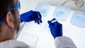 View from behind over the shoulder of a researcher. The pieces of gel lie in several containers on a light table. The researcher is holding a scalpel and tweezers to cut small pieces out of the gel.