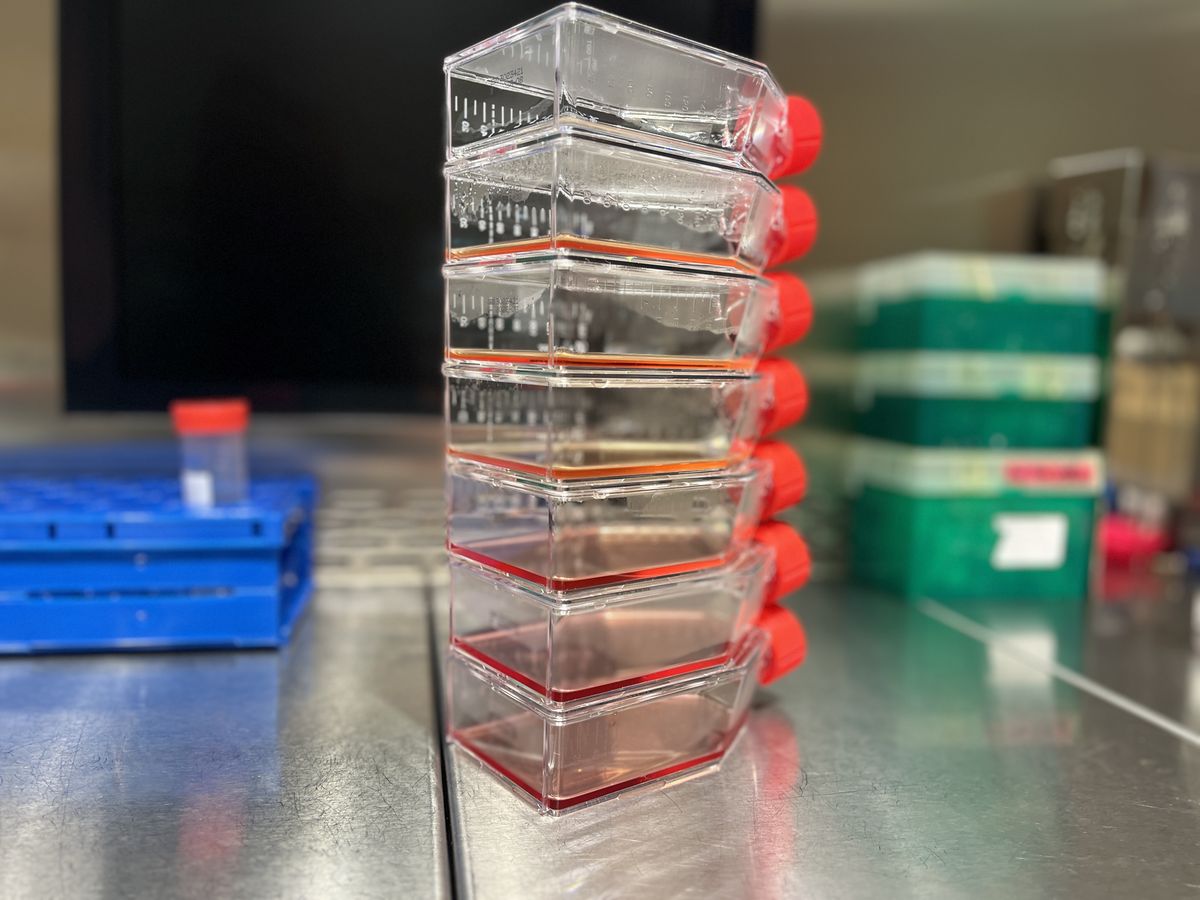 Verschiedene Stadien der Zelltypenkultivierung für die Arterioskleroseforschung — Diana Faist — Wir untersuchen die Beteiligung verschiedener Zelltypen bei der Entwicklung von arteriosklerotischen Plaques. Diese benötigen Medium mit einem pH-Indikator zur Nährstoffaufnahme und Kollagen als Untergrund (oberste Flasche), gefolgt von dicht bewachsenen Makrophagen (orangenes Medium) und Fibroblasten (rötliches Medium).