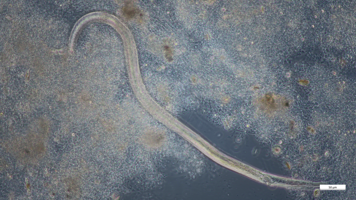 Marine worm within a biofilm —  Cesar Alfonso Zamora — During a research project, I collected 10 liters of marine water from Spiekeroog, Germany, and placed it in a bioreactor to monitor the growth of marine archaea and bacterial communities under oligotrophic conditions. Over the 42-day experiment, a biofilm formed on the temperature sensor and the walls of the bioreactor. To my surprise, this biofilm became a microenvironment housing not only algae and various microorganisms but also this marine worm. Interestingly, these worms were not observed in the liquid phase, highlighting the complexity and adaptability of life in even the most unexpected places. Photo taken with microscope camera ZEISS Axiocam 208 color.