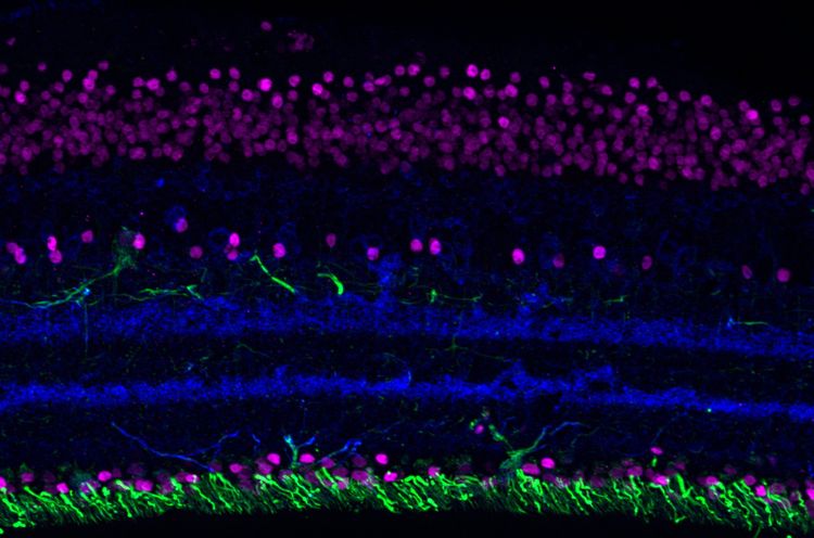 visible vision — Janne Brokate — Was auf den ersten Blick wie abstrakte Kunst wirkt, ist ein Sinnbild für die Wunder der Natur: Im Rahmen meiner Bachelorarbeit habe ich verschiedene Zellen der Netzhaut mit fluoreszierenden Antikörpern angefärbt und unter dem Mikroskop fotografiert. Schönheit liegt eben nicht nur im Auge des Betrachters sondern manchmal auch im Betrachten eines Auges. 