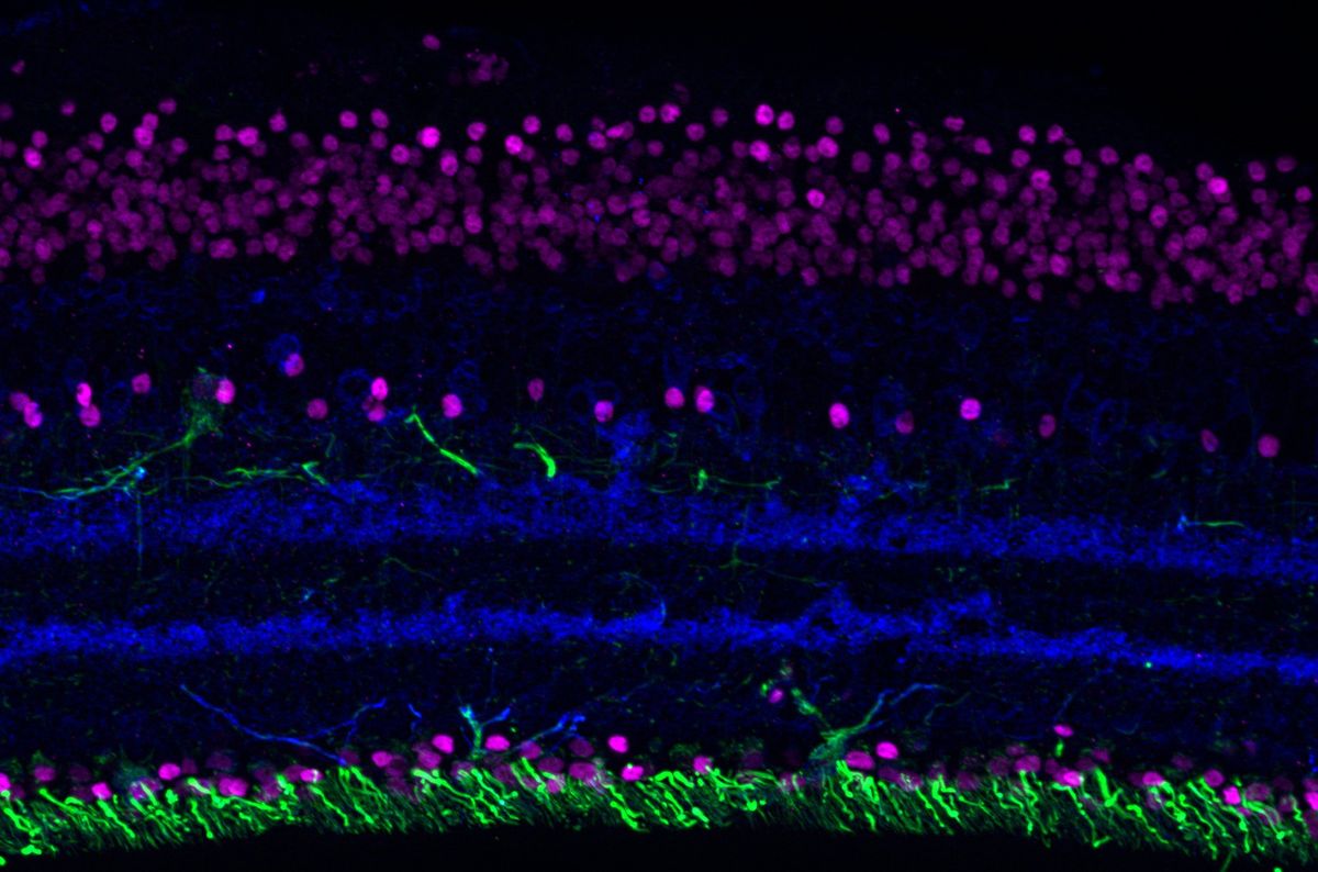 visible vision — Janne Brokate — Was auf den ersten Blick wie abstrakte Kunst wirkt, ist ein Sinnbild für die Wunder der Natur: Im Rahmen meiner Bachelorarbeit habe ich verschiedene Zellen der Netzhaut mit fluoreszierenden Antikörpern angefärbt und unter dem Mikroskop fotografiert. Schönheit liegt eben nicht nur im Auge des Betrachters sondern manchmal auch im Betrachten eines Auges. 