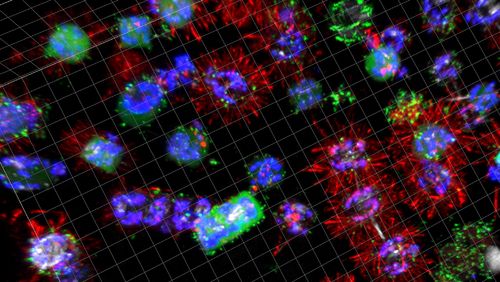A number of differently colored algal cells are spread across the image against a black background, some have tuftlike hairs. They are colonized by bacteria to varying degrees.