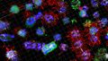A number of differently colored algal cells are spread across the image against a black background, some have tuftlike hairs. They are colonized by bacteria to varying degrees.