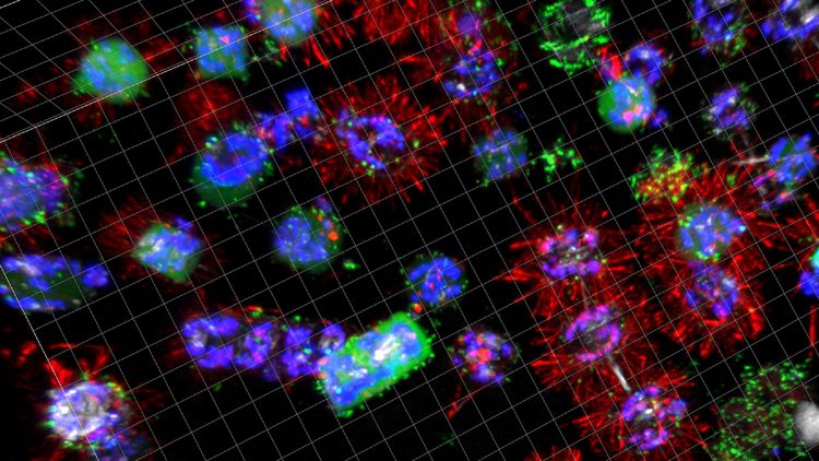 A number of differently colored algal cells are spread across the image against a black background, some have tuftlike hairs. They are colonized by bacteria to varying degrees.