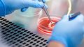 Two hands with tweezers hold a piece of intestinal tissue that is in a petri dish filled with a liquid.